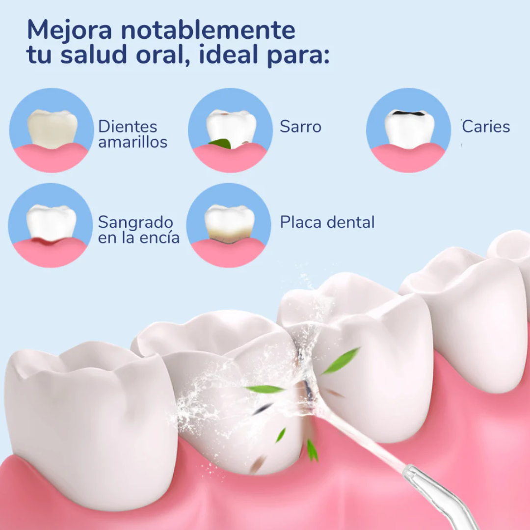 Limpia tus Dientes de manera fácil, rápida y efectiva con el Irrigador Bucal.