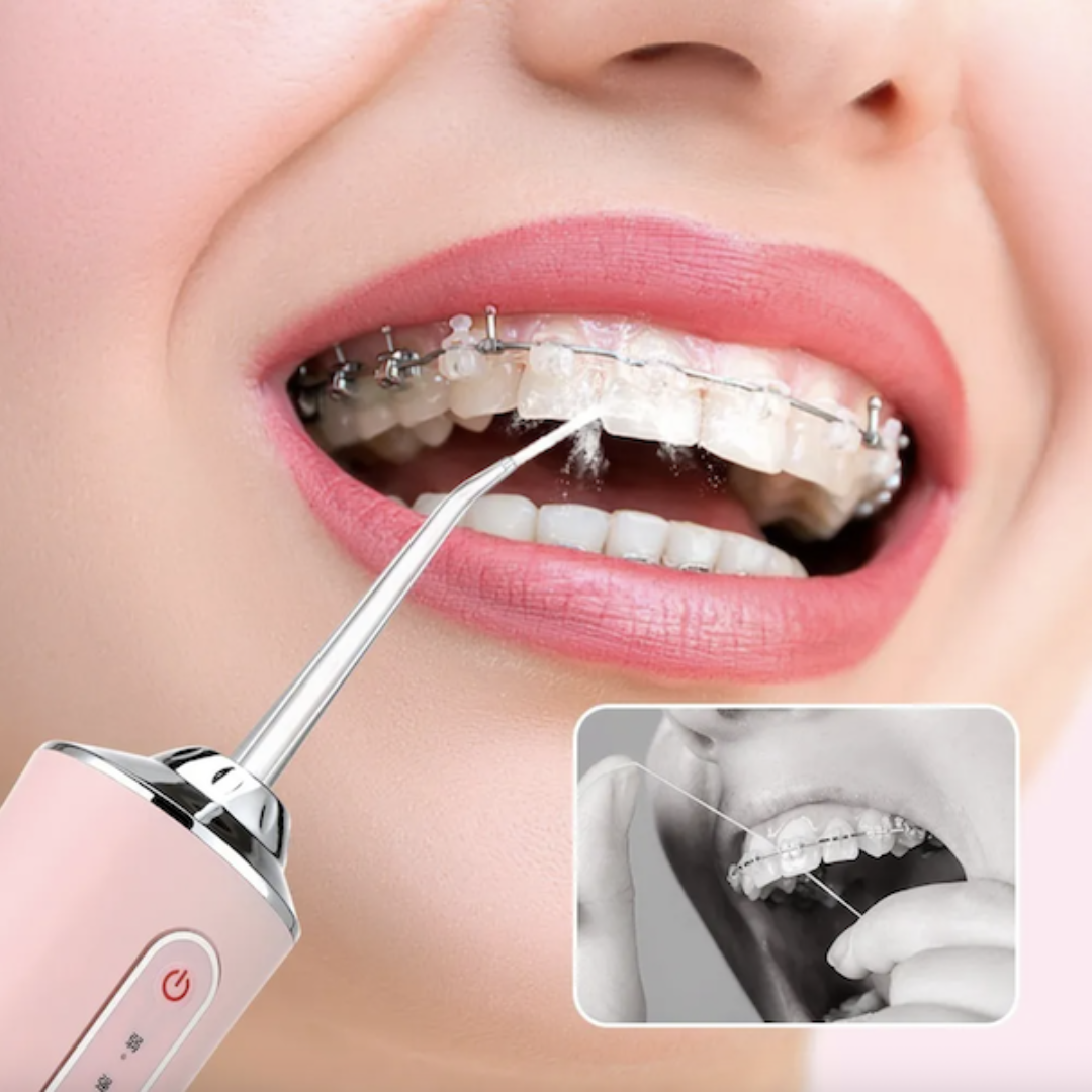 Limpia tus Dientes de manera fácil, rápida y efectiva con el Irrigador Bucal.